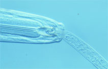 Beneficial Nematode eating a root feeding nematode
